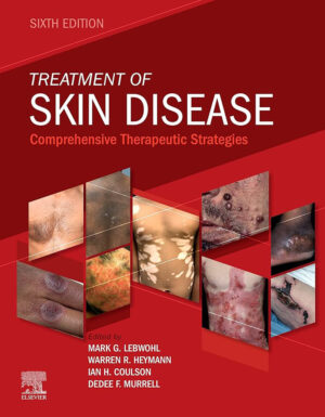 Treatment of Skin Disease Comprehensive Therapeutic Strategies