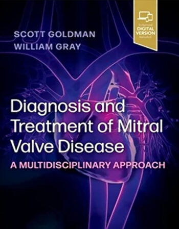 Diagnosis and Treatment of Mitral Valve Disease 2