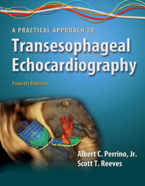 Practical Approach to Transesophageal Echocardiography