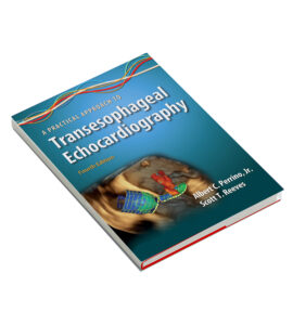 Practical Approach to Transesophageal Echocardiography